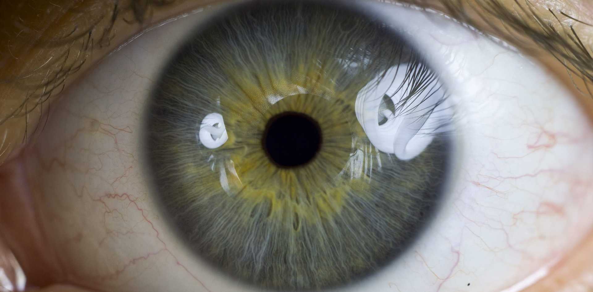 Glaukoma ir katarakta – klastingos akių ligos